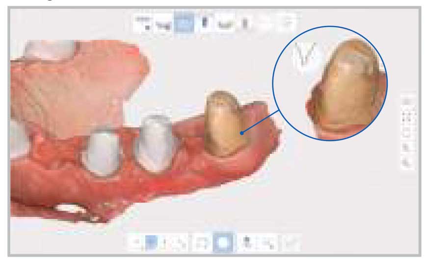 اسکنر داخل دهانی Medit - i700